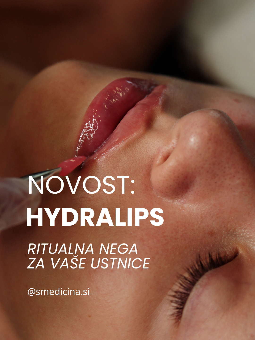 Novo: HydraLips